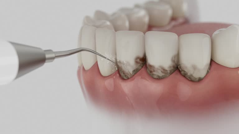 Trusted Teeth Cleaning And Checkup service in Paoli, IN - Dentist Open Now